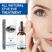 Solution oculaire - 30 ml - Soin des yeux nettoyant pour les yeux sensibles - Nettoyant apaisant pour les paupi res - Produits de soin naturels pour la peau pour adultes sensibles - Pour le bureau - Buy Online on GoSupps.com