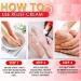 Arching Bunion Relief Cream | Topical Ointment for Arthritis & Joint Pain | Effective Bunion Pain Relief (1PC) - Buy Online on GoSupps.com