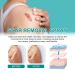 Scar Removal Spray - 2pcs Stretch Mark Remover 20g Gentle Skin Care - Buy Online on GoSupps.com