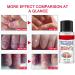 Extra Strong Fungal Nail Treatment 20ml - Premium Toenail and Fingernail Fungus Eliminator - Anti-Fungal Repair and Strengthening - 1 PCS - Buy Online on GoSupps.com