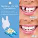 70PCS Temporary Tooth Repair Kit | False Tooth Replacement & Crowns | Front Teeth Repair | Denture & Oral Care - Buy Online on GoSupps.com