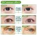 Invisible Slim Eyelid Tapes Stickers 300 Pairs - Medical-use Fiber Eyelid Strips for Instant Lift - Perfect for Hooded, Droopy, Uneven, Mono-eyelids - Green - Buy Online on GoSupps.com