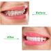 Buy Bobozhong Aligner Chewies 2PCs Silicone Orthodontic Bite Helpers for Invisible Braces Care - Buy Online on GoSupps.com