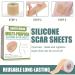 Medical Grade Silicone Scar Sheets - C-Section Surgery Burn Keloid & Acne Treatment | 1.6 x 60 Roll - Buy Online on GoSupps.com