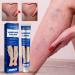 Natural Varicose Veins Relief Cream for Legs - Spider Vein & Varicose Vein Treatment - Buy Online on GoSupps.com