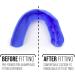 3D Mouth Protection OSFA - Royal Blue for Ages 7+ | International Shipping Available - Buy Online on GoSupps.com