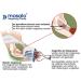 Masalo Cuff MED for Tennis Elbow & Golfer's Elbow - Size 2 Left Arm | International Shipping Available - Buy Online on GoSupps.com