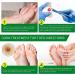 Small Corn Removal Pads for Feet & Toes - 40% Salicylic Acid | 24 Pack Callus Remover for Effective Foot Care - Buy Online on GoSupps.com