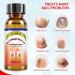 Extra Strength Toenail Fungus Treatment - 30ML Nail Solution with Soft Brush - Transform Your Nails & Boost Confidence - Buy Online on GoSupps.com