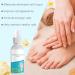 Foot spray Skin Foot Spray Moisturizing Nutrition Protection 50ml Foot Care for Comfort Itching Relief Soothing Fragrance for Everyone - Buy Online on GoSupps.com