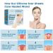 Medical-Grade Silicone Scar Sheets for Surgical Scars, Keloids, and Stretch Marks - 1.6 x 120 inches - Buy Online on GoSupps.com