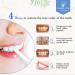 Teeth Whitening Pen (5 Pcs) | Visibly Whiter Teeth in 1 Week | 80+ Uses | 1 Month Supply - Buy Online on GoSupps.com