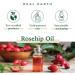Real Earth Stories Rose hip oil 100% pure and cold pressed healing anti-stretch marks anti-wrinkle and regenerating oil for the whole body even for acne and blemishes (100 ml) - Buy Online on GoSupps.com