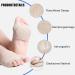 Zakasa Bale Cushion - Gel Silicone Forefoot & Midfoot Pads for Men & Women - Anti-Slip Soft Comfort - Size S Skin Color - 1 Pair - Buy Online on GoSupps.com