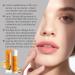  G n rique Moisturizing Lip Balm Beeswax Stick 5g Lip Butter - For Women and Men Dry Chapped Lips All-Day Hydration Natural Finish Evolving - Buy Online on GoSupps.com
