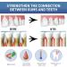 Gum Instant Treatment Gel Gum Instant Soothing Gel Perispot Gum Gel for Teeth Whitening Essence Pen - Buy Online on GoSupps.com
