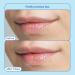 Skinfix Barrier+ Triple Lipid Lip Treatment - Nourish & Plump Dry Lips | 0.27 Oz - Buy Online on GoSupps.com