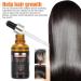 30ML Hair Growth Oil - Prevent Hair Loss Nourish Deeply Repair Follicles & Combat Frizz - Buy Online on GoSupps.com