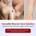MEDca Silicone Foam Dressing w/ Adhesive Border - 3x3 Waterproof Bandages for Wounds (Pack of 10) - Highly Absorbent Bandage Care for Bed Sores Pressure Sores & Ulcers - Buy Online on GoSupps.com