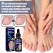 3PCS German Toenailcare Removal Paronychia Oil Treatment & Relief for Healthy Toenails - Buy Online on GoSupps.com