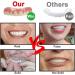 Professional Denture Reline Kit - Fake Braces for Cosmetic Teeth - Natural Shade Veneer Set for Confident Smile - Buy Online on GoSupps.com