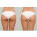 LuxeJoie Cellulite Recovery Cream 21-Day Challenge for Booty, Hips & Thighs - 4oz - Buy Online on GoSupps.com