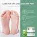 Urea 40% Foot Cream Tea Tree Urea Foot Cream Urea Foot Cream 40% Cracked Heel Repair Cream 40% Urea Cream Intensive Exfoliating Foot Cream Foot Cream for Cracked Heels and Dry Skin - Buy Online on GoSupps.com