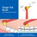 TEPE Interspace Soft Angled Toothbrush with Pointed Tuft - 1 Handle, 12 Detachable Brush Tips - Buy Online on GoSupps.com