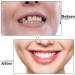 Instant Perfect Snap-On Veneers - 2 Pairs of Comfortable False Teeth for a Perfect Smile | Teeth Whitening Kit Included - Buy Online on GoSupps.com