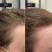 Natural Hair Growth Oil Daily Oil Natural Fluid With Vegetable Extracts Scalp Care Promoting Regrowth For Adults Men Women - Buy Online on GoSupps.com