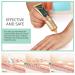 RTBYUE Scar Removal Cream - 2 Pack TCM Cream for Surgical Scars, Acne & Stretch Marks - Buy Online on GoSupps.com