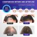 150ml Essence de Soin de Cheveux Mousse G n rique per r duire la fragilit Des Pour des plus pais et plus volumineux Pour Anti Chute Cheveux Femme et Homme Favorise la Pousse des Cheveux Plus pais - Buy Online on GoSupps.com