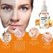 Turmeric Dark Spot Corrector Serum for Acne, Hyperpigmentation, Smooth Skin - 2PCS(60ml) - 1 Fl Oz - Buy Online on GoSupps.com