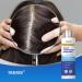 Ketoconazole Shampoo Kit | 1% Dandruff Treatment for Itchy Scalp & Psoriasis | 8.4oz Scalp Relief & Dermatitis Care - Buy Online on GoSupps.com