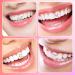 Tooth Gems Kit DIY - Professional Crystal Teeth Jewelry for a Fashionable Smile | No Glue Needed - Buy Online on GoSupps.com