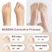 6 Pairs Women's Toe Socks for Bunions - Low Cut Non-Slip Breathable Bunion Corrector USA Made Five Finger Socks - Buy Online on GoSupps.com