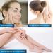 Underarm Whitening Cream | Skin Lightening & Brightening for Intimate Areas | Dark Spot Remover for Neck Elbow Knees & Bikini - 1.8oz - Buy Online on GoSupps.com