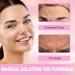 Zornesfalte Plasters - Akissos Silicone Reusable Face Tape for Wrinkles Forehead Wrinkles 11 Lines - Used Overnight Anti Wrinkle Plasters Moisturising & Forehead Wrinkle Patches - Buy Online on GoSupps.com