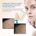 Aroamas Silicone Scar Sheets - Soften & Flatten Scars from Surgery, Burns, C-Section | 8 Sheets - 4 Month Supply - Buy Online on GoSupps.com