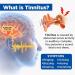 Acupeace Tinnitus Relief Device - Premium Solution for Ringing Ears - 2023 Edition | 1 Pair - Buy Online on GoSupps.com