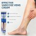 Varicose Veins Cream for Natural Treatment - Strengthen Capillary Health, Improve Blood Circulation - 20g - Buy Online on GoSupps.com