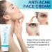 Face Acne Cream Anti Acne Face Cream Anti Acne Removal Cream Facial Smooth Care Acne Moisturiser Dark Spot Remover for Face and Body Acne Moisturiser - Spot Cream for Teenagers Women Men - Buy Online on GoSupps.com