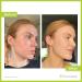 Maximum-Strength 10% Benzoyl Peroxide Acne Wash for Face, Skin, Butt, Back & Body - 8 oz - Vegan & Cruelty-Free - Buy Online on GoSupps.com