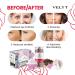 Velyt Ice Ball Cold Therapy for Face-Rose Tea (70gr) - Brightens Skin, Reduces Puffiness & Wrinkles - Buy Online on GoSupps.com
