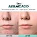 RECIPE Azelaic Acid 10 Soothing Ampoule - Soothing Serum Facial Serum for Sensitive skin - Korean Skincare for Mild Breakouts (1.01 fl oz) - Buy Online on GoSupps.com