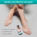 Nail Fungus Treatment for Toenail Fungal Nail Treatment Extra Strong Toe Nail Repair Kit for Thick Damaged Discolored Nails 30ML 30 ml (Pack of 1) - Buy Online on GoSupps.com