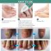 Extra Strong Fungal Nail Treatment 10ML - Toe & Finger Nail Fungus Solution - Strengthen, Repair & Renew Damaged Nails - 2Pcs - Buy Online on GoSupps.com