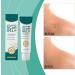  YNPQTDS Scar Gel 50g Moisturizing Gel for Burn Marks Burn Mark Cream | For Post-Operative Injury Recovery Athletes' Daily Routine Knees - Buy Online on GoSupps.com