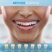 Teeth Whitening Pen Bleaching Gel - 3 Pcs Professional 20 Uses - Effective, Painless, No Sensitivity - Easy to Use Tooth Whitener for Home & Travel - Beautiful White Smile (White) - Buy Online on GoSupps.com
