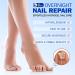 Patchs pour les Mycoses des Ongles (21 pi ces) Traitement et R paration des Mycoses des Ongles des Pieds Multi-usages pour les Ongles pais Fissur s et D color s Soin et R paration des Ongles Ab m - Buy Online on GoSupps.com